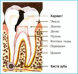 Схема зуба