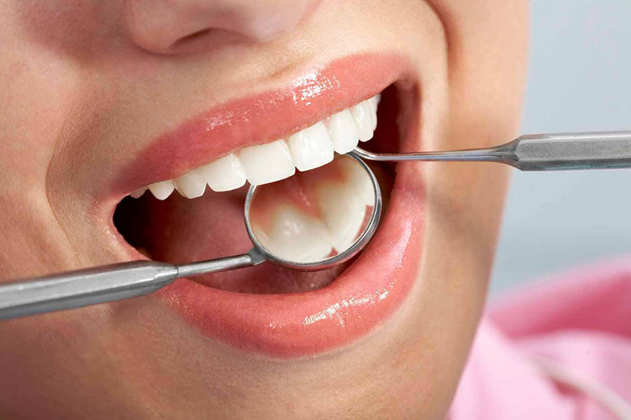 Здоровые зубы пациента